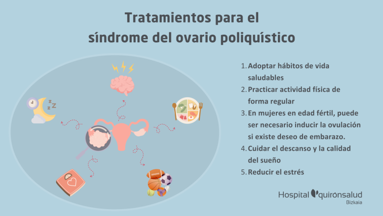 2 ndp sindrome de ovario poliquistico 
