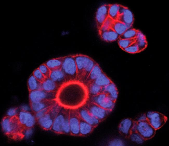 Científicos del IRB logran predecir la metástasis del cáncer colon | IRB BARCELONA - Archivo ep cientificosirb logran predecirmetastasiscancer colon
