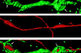 ep esferasactina verde envueltas alrededorun axon seccionado rojo