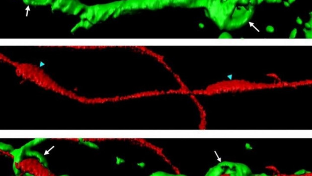 ep esferasactina verde envueltas alrededorun axon seccionado rojo