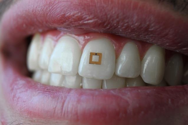 Implante dental | TUFTS NOW ep implante dental