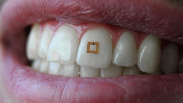 ep implante dental