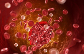 ep sangre trombosis 20200316135903