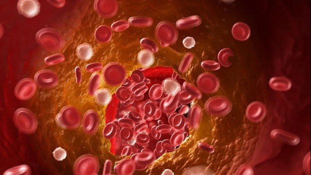 ep sangre trombosis 20200316135903