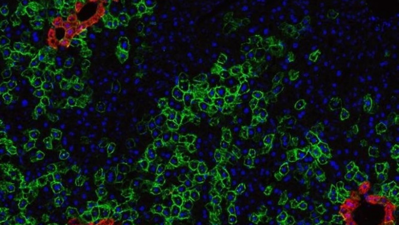 Células madre (en rojo) del hígado de un ratón | LABORATORIO NUSSE/HHMI - Archivo ep celulas madre en rojo del higadoun raton 20190819105504