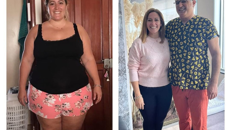 manga gastrica turquia antes despues