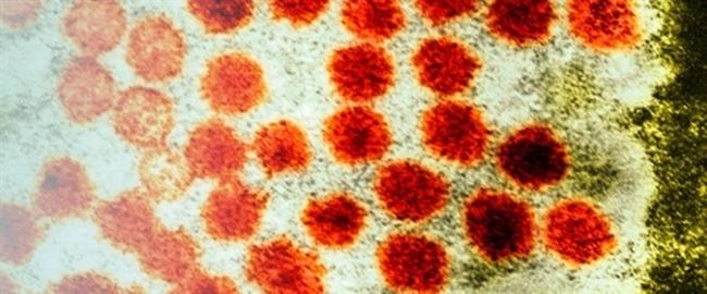 Hepatitis A | ECDC ep hepatitis a