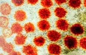 ep hepatitis a
