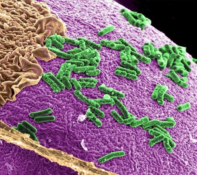 Imagen de archivo de una bacteria intestinal | ARCHIVO ep imagenarchivouna bacteria intestinal