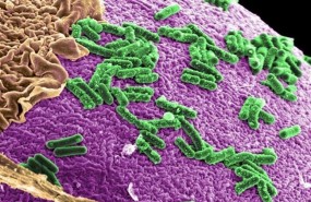 ep imagenarchivouna bacteria intestinal