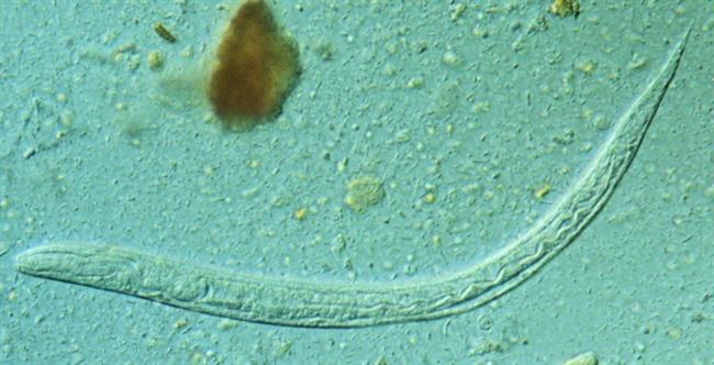 Larva del helminto intestinal Strongyloides stercoralis | CDC/SINC ep larvahelminto intestinal strongyloides stercoralis