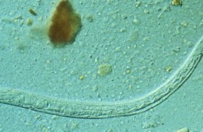 ep larvahelminto intestinal strongyloides stercoralis