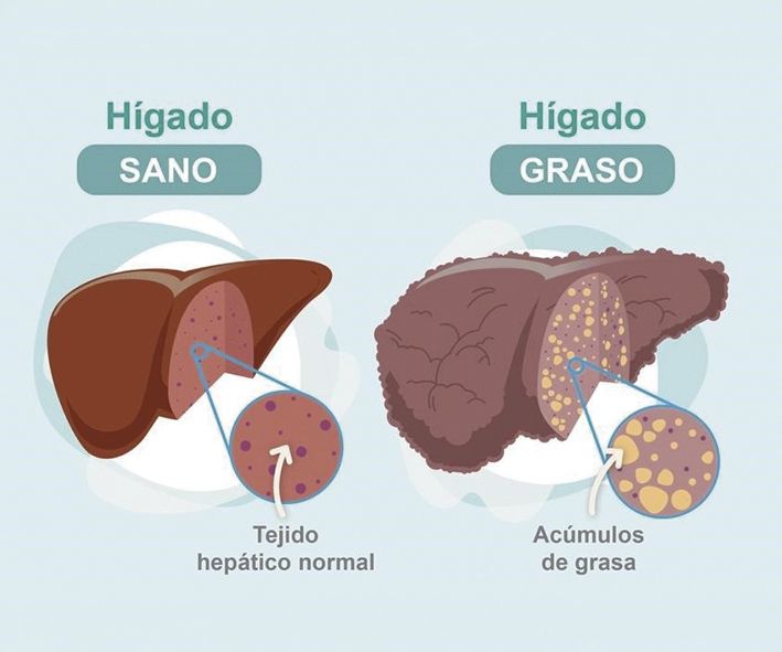 higado