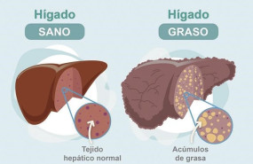 higado higado