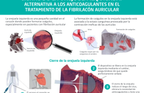2 cierre de la orejuela 