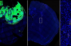 ep de izqder imagenun cerebroratontumor establecido normalmente cerebroratonquehan inyectado celulasla expresionnfatc3 bloquedada y ampliacionlascelulas tumorales localizadaseste ultimo cerebro