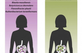 ep hallanprimera vez variacionesla composicionlos microbiomaspacientesfibromialgia