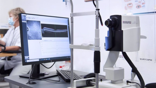 ep archivo   tomografo de coherencia optica aparato utilizado para la deteccion de la degeneracion