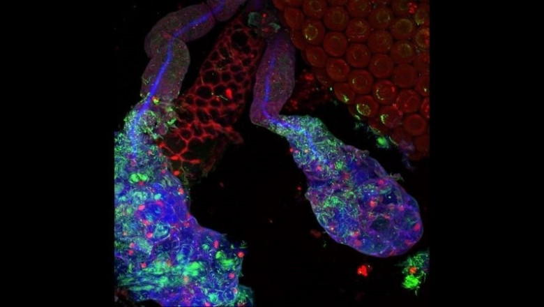 Glándula salival de una hembra del mosquito Anopheles. Las células salivales se muestran en rojo y su contenido celular en azul. Los parásitos que causan la malaria se muestran en verde. | ANDREW LAB ep glandula salivaluna hembramosquito anopheles las celulas salivalesmuestranrojosu contenido celularazul los parasitoscausanmalariamuestranverde