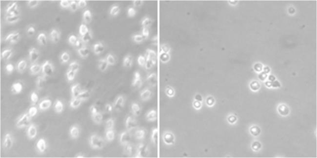 Linfoma | INSTITUT D'INVESTIGACIÓ BIOMÈDICA DE BELLVITGE ep linfoma