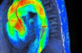 ep resonancia magnetica cardiaca 4d