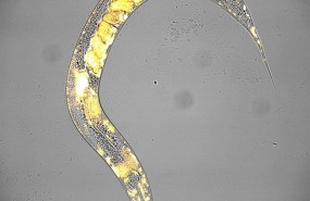 ep gusano nematodo caenorhabditis elegans con embrionessu interior