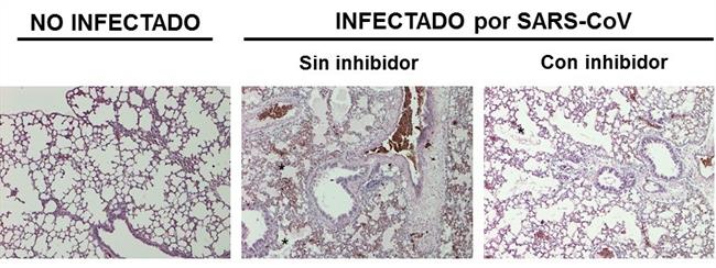 Sección de pulmón de un ratón sano e infectado, con y sin tratamiento | CNB-CSIC ep seccionpulmonun raton sano e infectado consin tratamiento