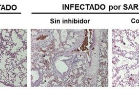 ep seccionpulmonun raton sano e infectado consin tratamiento
