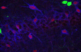 ep una investigacion de incliva proporciona nuevos datos acerca de las alteraciones del cerebro en