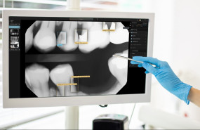 second opinion second opinion