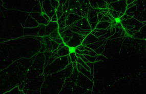 ep dos neuronas en cultivo