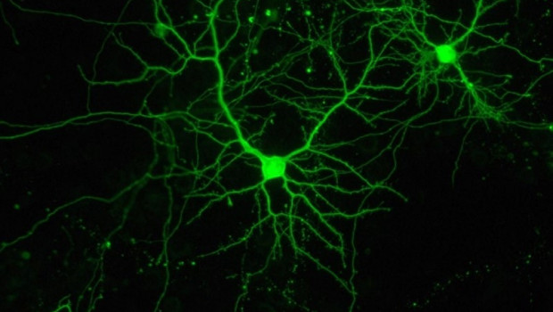 ep dos neuronas en cultivo