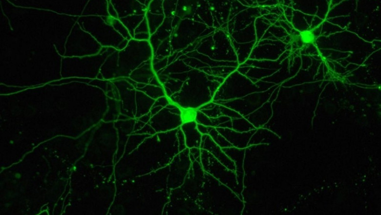 Dos neuronas, en cultivo. | INSTITUTO DE NEUROCIENCIAS - Archivo ep dos neuronas en cultivo