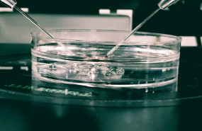 ep un hidrogelsimulaendometrio podria aumentartasas de exitolos tratamientos reproductivos segun ivi