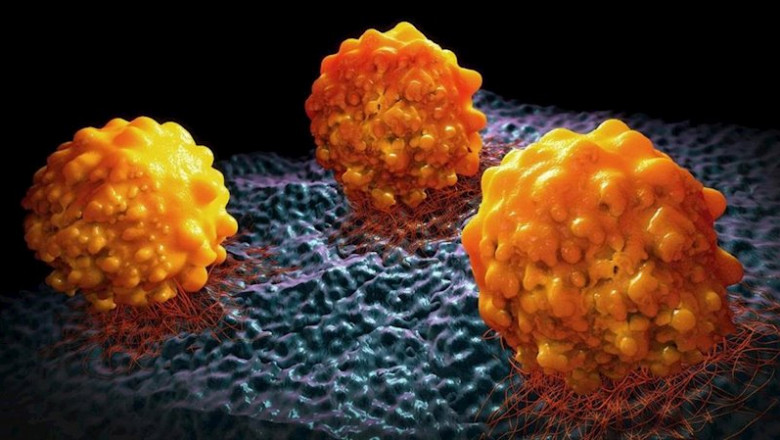 Cáncer de páncreas | UNIVERSITY OF LOUVAIN - Archivo ep cancer de pancreas 20200316112209