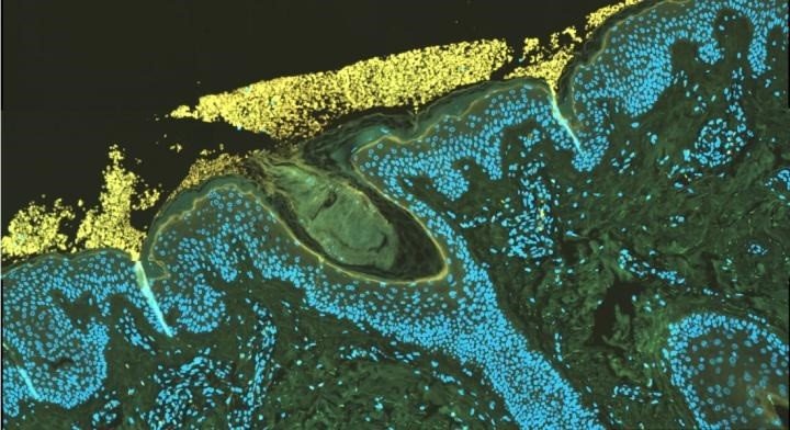Una sección transversal de la piel humana | LENE BAY, UNIVERSIDAD DE COPENHAGUE. ep una seccion transversal de la piel humana