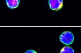 ep la imagen de inmunofluorescencia muestra cd3 verde tet2 rojo y dapi azul en celulas t cd4 humanas