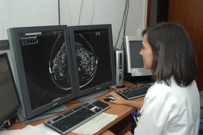 Radiografía de una mamografía. | ERUOPAPRESS/JUNTA ANDALUCÍA ep radiografiauna mamografia
