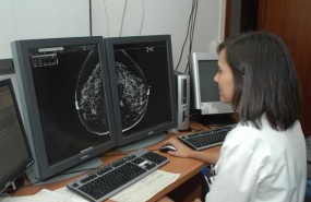 ep radiografiauna mamografia