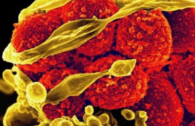 ep staphylococcus aureus estafilococo microbio