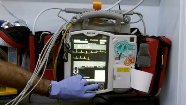 ep electrocardiogramasamu-061