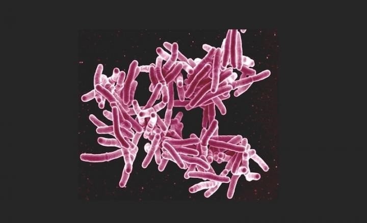 ep mycobacterium tuberculosis la bacteria causante de la tuberculosis