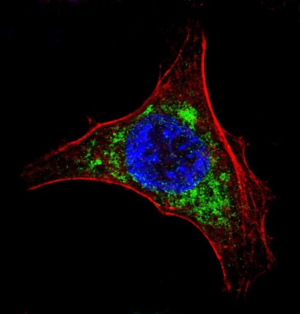 ep virus hepatitis c