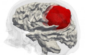 ep crean celulas madrecancer cerebral mediante ingenieria inversahallar objetivostratamiento