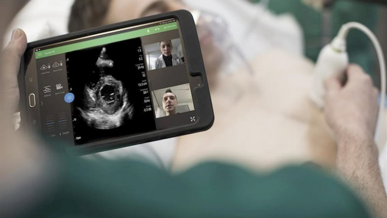 ep philips-lumify-with-reacts-ultrasound-low ep philips-lumify-with-reacts-ultrasound-low