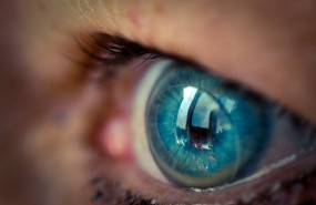 ep lentillas ojo