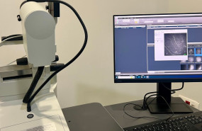 clinica con microscopia confocal madrid