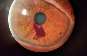 pincelada natural   ptica nueva   stefani vasileva 