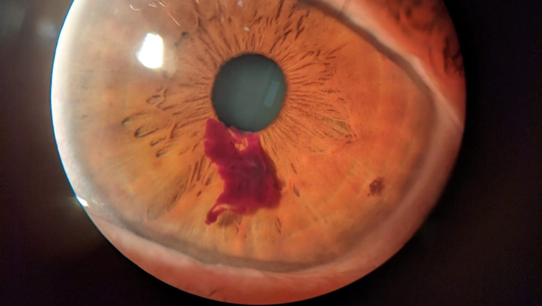 pincelada natural   ptica nueva   stefani vasileva 