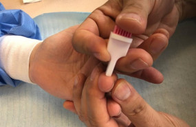 ep un test serologico
